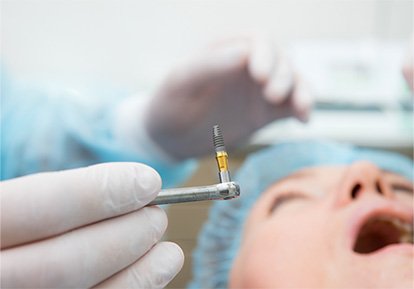 dentist about to perform a dental implant procedure